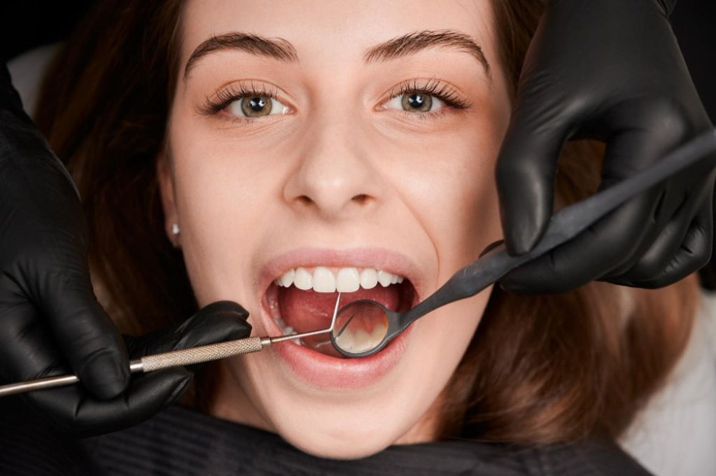 5 motive pentru care să-ți faci un detartraj dentar